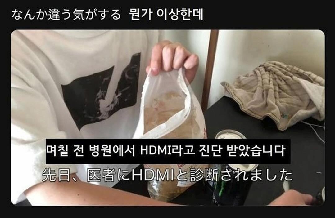 며칠 전 병원에서 HDMI